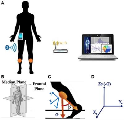 l-DOPA and Freezing of Gait in Parkinson’s Disease: Objective Assessment through a Wearable Wireless System